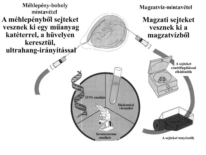 terhesség alatti szűrési módszerek
