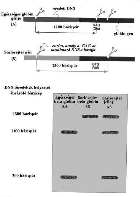 DNS-analízis, sarlósejt-diagnózishoz